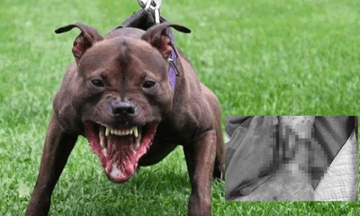 Bị chó pitbull tấn công, 4 người trong gia đình phải nhập viện cấp cứu
