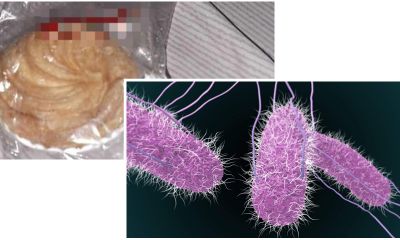 Vụ ngộ độc hàng loạt sau tiệc trung thu: Tìm thấy vi khuẩn salmonella
