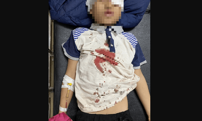 Tuyên Quang: Bốn bé trai trọng thương, nghi do tự chế pháo nổ
