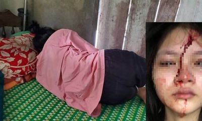 Thừa Thiên - Huế: Nữ sinh lớp 10 bị bạn dùng mũ bảo hiểm đánh chấn động não