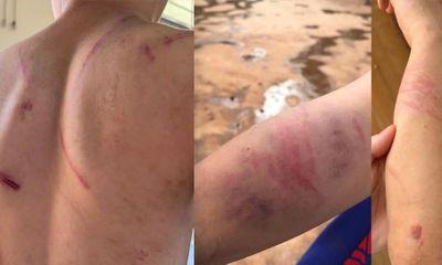 Vụ bé trai 9 tuổi nghi bị bố ruột đánh đập dã man ở Đắk Lắk: Sức khỏe nạn nhân ra sao?
