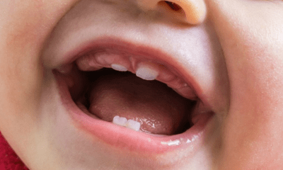 Nhật Bản sẽ phát triển loại thuốc giúp răng mọc lại nhiều lần