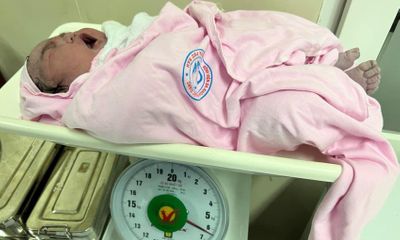 Bé gái ở Bắc Giang chào đời với cân nặng 6,2kg